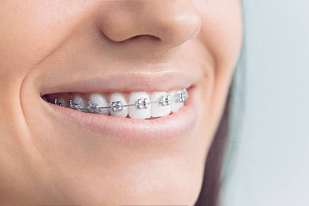 Best Invisalign and Clear Aligners  in Vandalia, IL